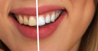 teeth