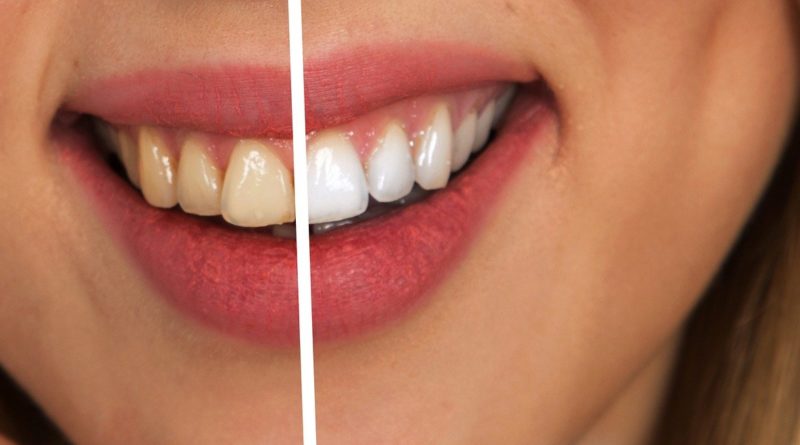 teeth